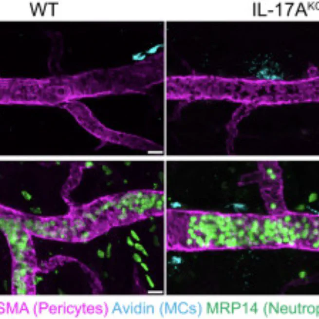 Neutrophil breaching of the blood vessel pericyte layer during diapedesis requires mast cell-derived IL-17A